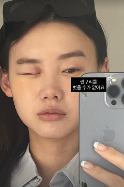 'SBS 최연소 아나운서', 믿기지 않는 눈 상태+핸드폰 뒷면…워킹맘 현실인가