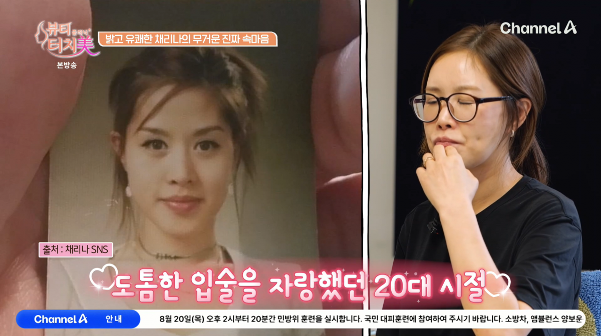 사진=채널A '뷰티 클리닉 터치미'