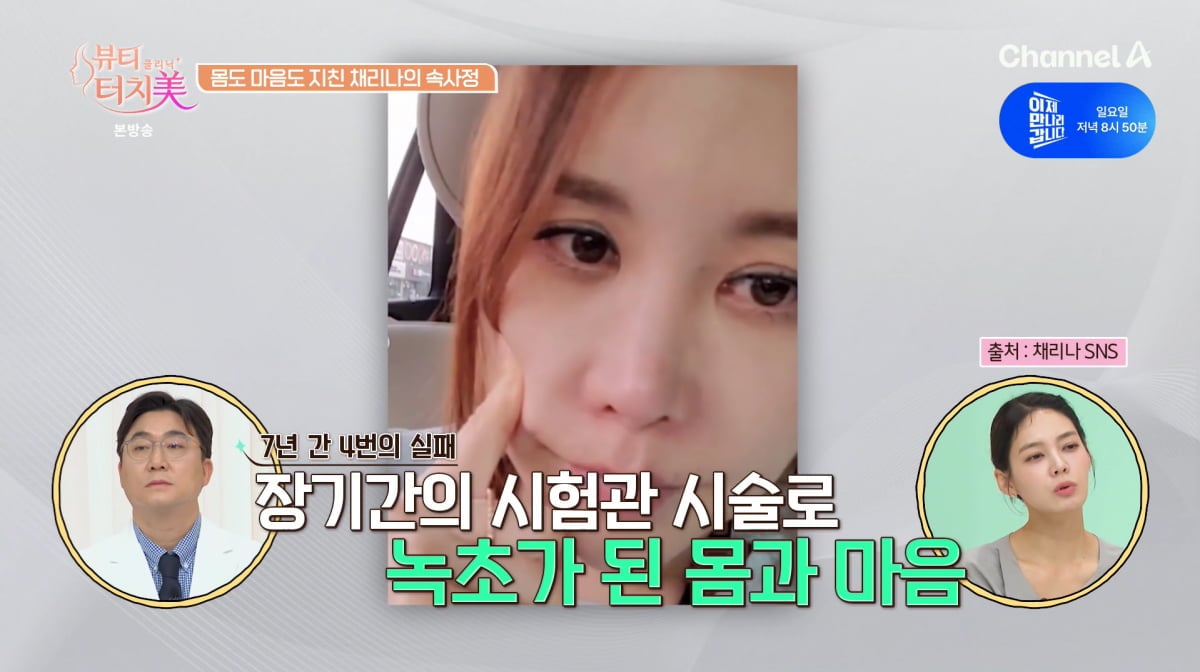 사진=채널A '뷰티 클리닉 터치미'
