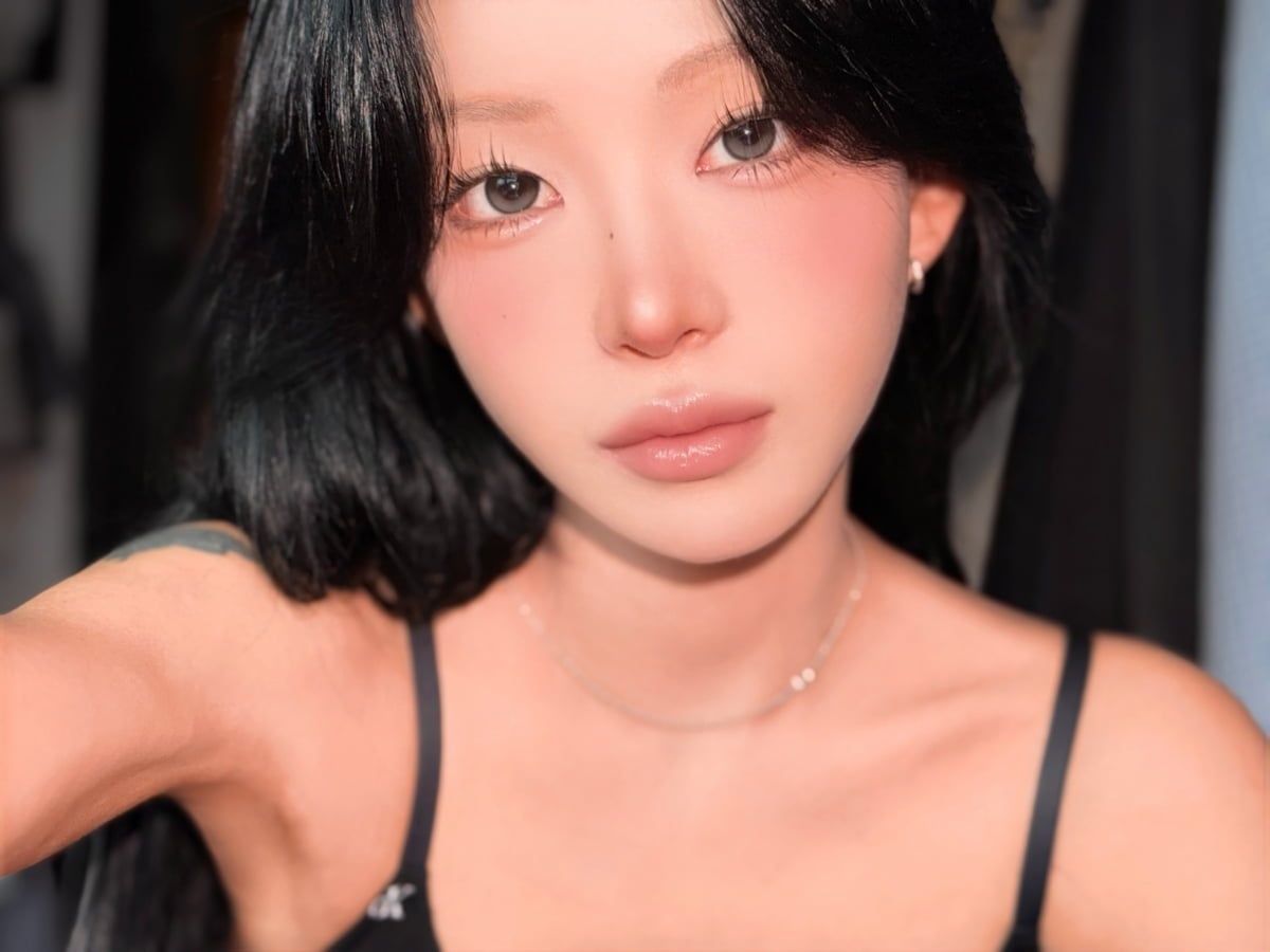 배우 고(故) 최진실의 딸이자 인플루언서 최준희가 눈 성형수술 직후 근황을 공개했다./ 사진=SNS