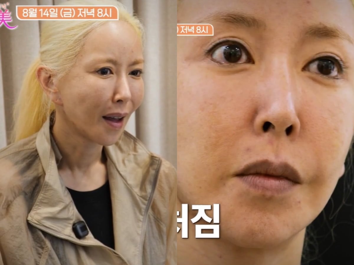 SES 슈 맞아? 얼굴 어쩌다 이렇게 됐나…"흘러내려"