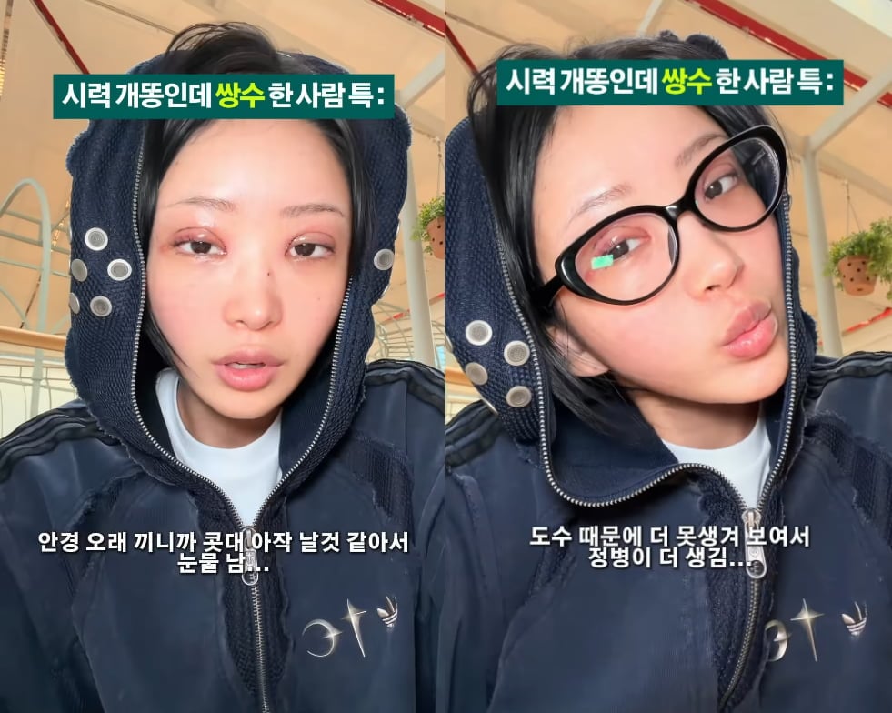 배우 고(故) 최진실의 딸이자 인플루언서 최준희가 쌍꺼풀 수술 후 불편함을 토로했다. / 사진=SNS