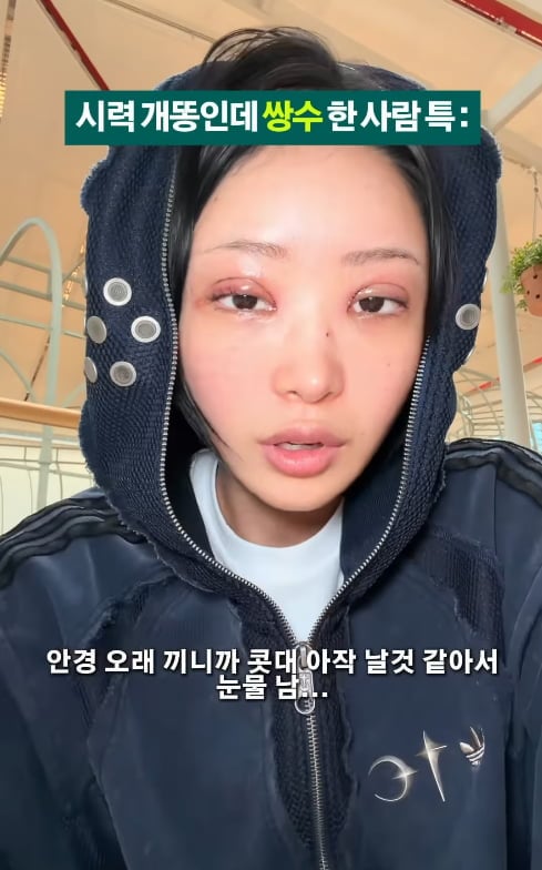배우 고(故) 최진실의 딸이자 인플루언서 최준희가 쌍꺼풀 수술 후 불편함을 토로했다. / 사진=SNS