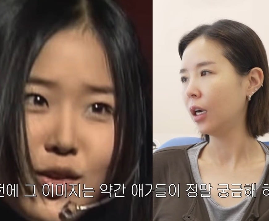 신지, 달라진 얼굴형…양악수술 해명 “위아래 다 뜯어 새로운 치아로”