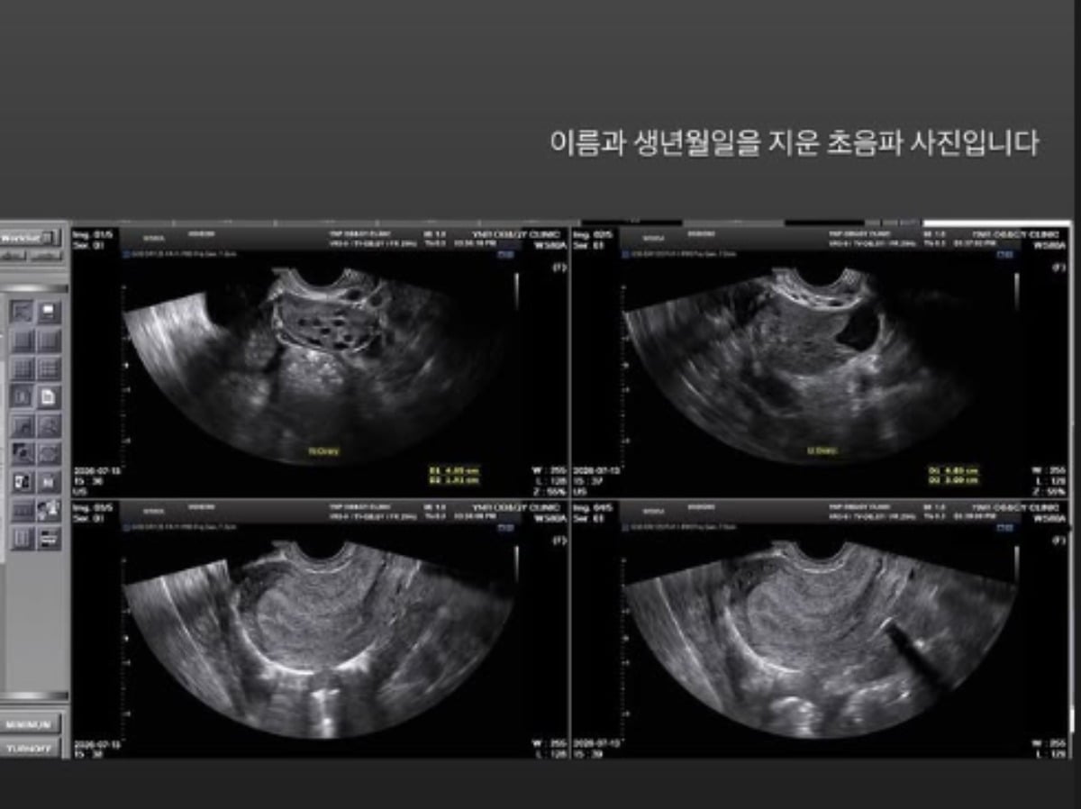배우 홍민기와 전 여자친구라고 주장하는 A씨의 공방이 이어지고 있다./사진=SNS 갈무리