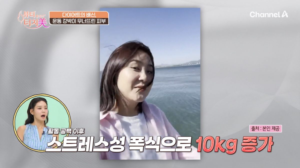 사진=채널A '뷰티 클리닉 터치미'