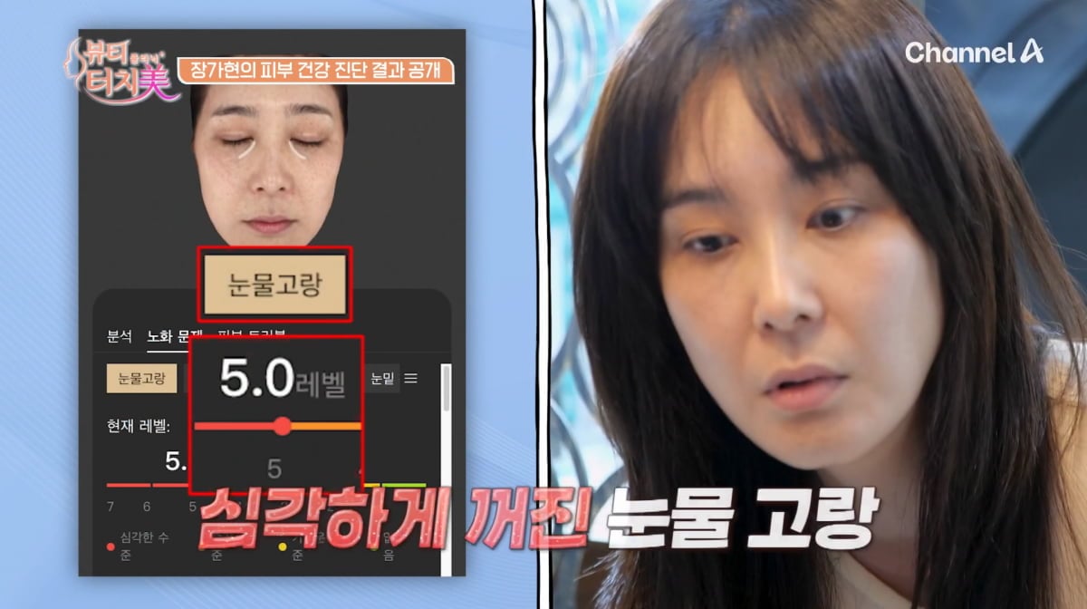 사진=채널A '뷰티 클리닉 터치미'