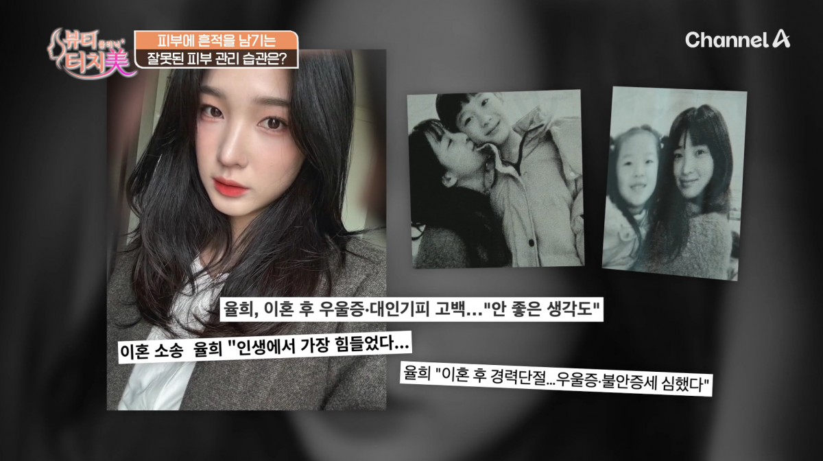 사진=채널A '뷰티 클리닉 터치미'