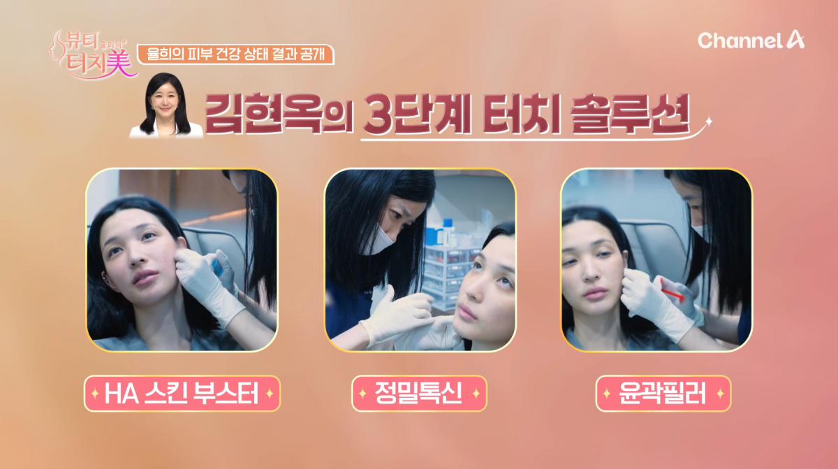 사진=채널A '뷰티 클리닉 터치미'