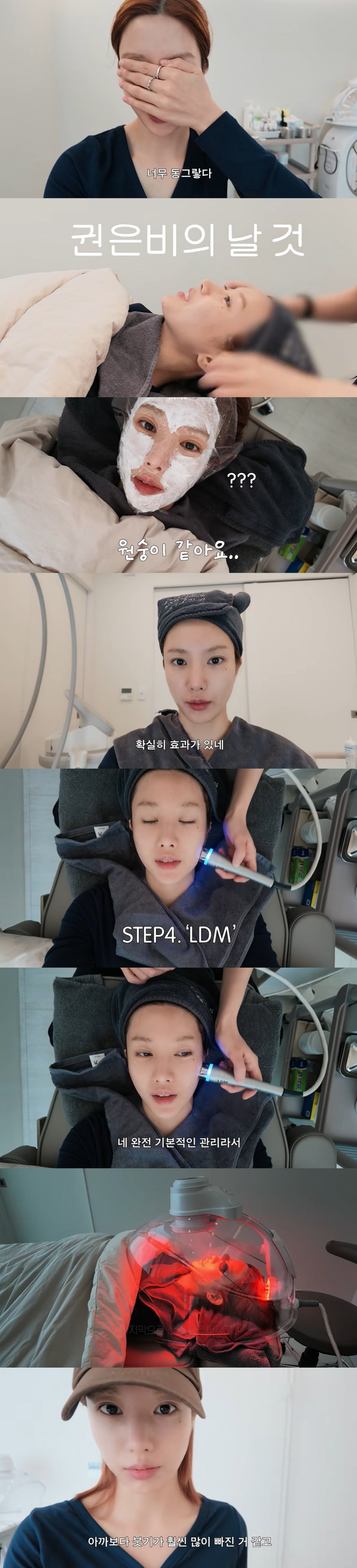 권은비가 컴백을 앞두고 리프팅 시술부터 운동, 식단까지 집중 관리에 나선 일상을 공개했다./사진=권은비 유튜브 채널 캡처