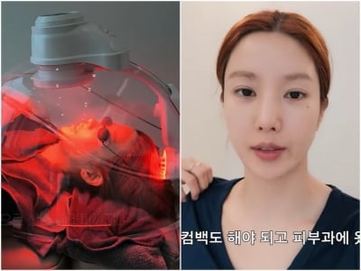 '24억 건물주' 권은비, 리프팅 시술 비포·애프터 과감히 공개…컴백 앞두고 집중 관리 ('권은비')