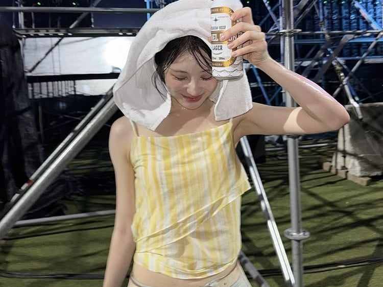 ‘모발이식’ 이채연, 머리 3571모 심은 후…모발에 물뿌려도 문제 없어