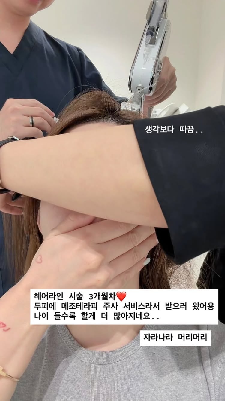 20기 정숙, 탈모고민 심했나…헤어 시술 3개월 차, 두피에 주사까지 따끔