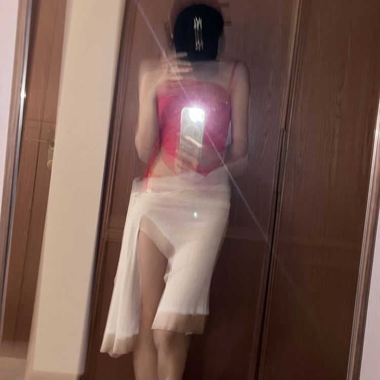 이채연, 모발이식 3571모 심은 후…수영장서 물 묻어도 OK