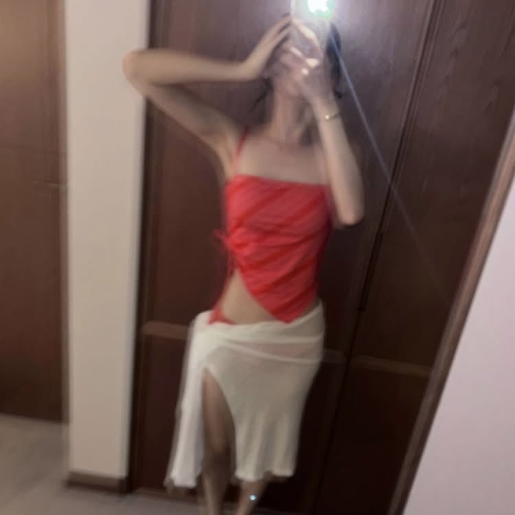 이채연, 모발이식 3571모 심은 후…수영장서 물 묻어도 OK