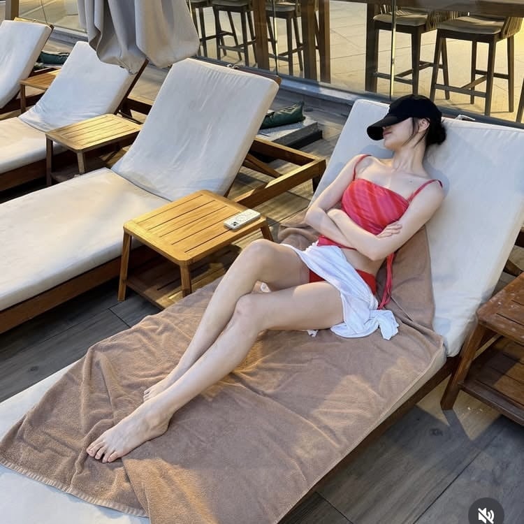 이채연, 모발이식 3571모 심은 후…수영장서 물 묻어도 OK