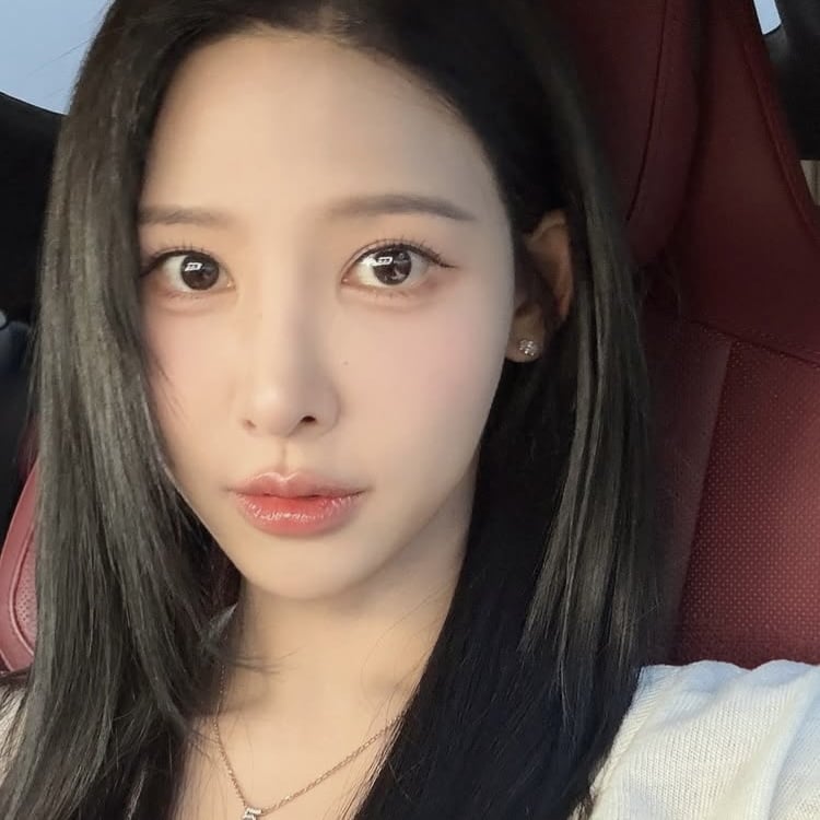 ‘M자 탈모’ 이나연, 1200모 모발이식 후…풍성해진 머리카락에 대만족