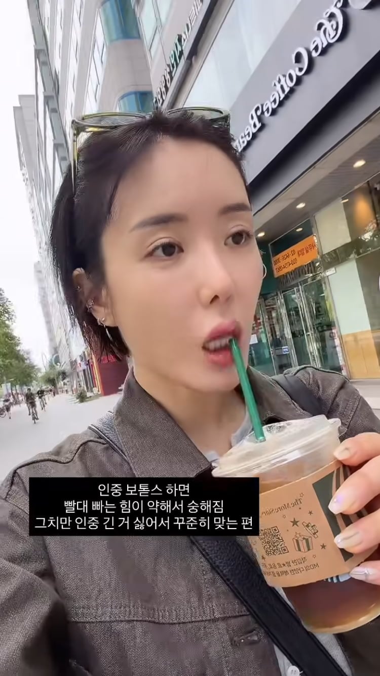 ‘가슴수술 1000만원’ 이소라, 인중에도 주사 맞아…“긴 거 싫어” 롱안부 탈피