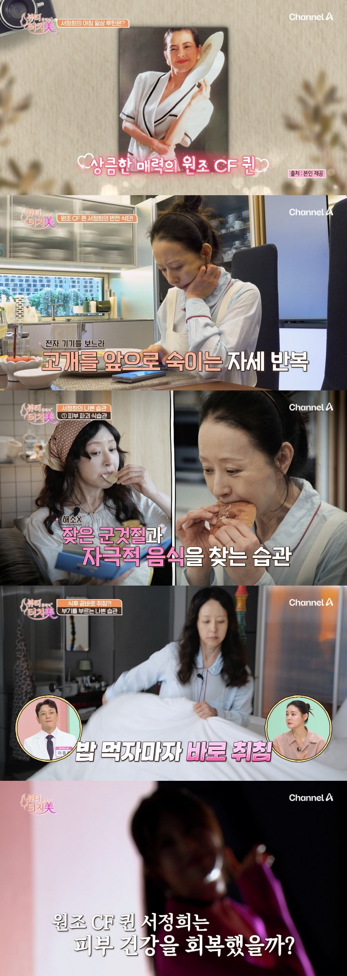 서정희가 피부 고민을 밝힌다./사진제공=채널A