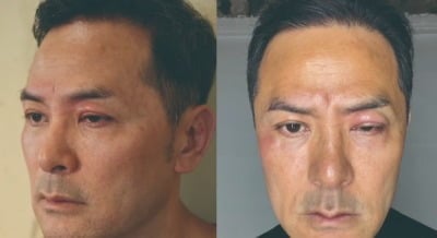 김창옥, 정신과 약 끊었다…심한 알레르기에 눈까지 부었지만, "위로 얻어" ('라스')