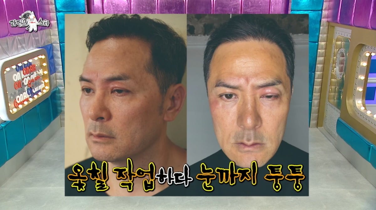 김창옥이 옻칠 작업을 하며 심한 알레르기를 겪었다고 밝혔다./사진제공=MBC