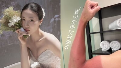 류화영, 맨살 타버린 '♥사업가' 걱정했다가 '맞춤법' 굴욕…정말 "어떻하지"