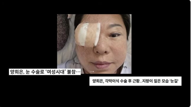 가수 양희은이 지난 6월 각막이식 수술을 받기 두 달 전 암 수술까지 받은 사실을 뒤늦게 공개했다.  / 사진=김영철 유튜브 채널 