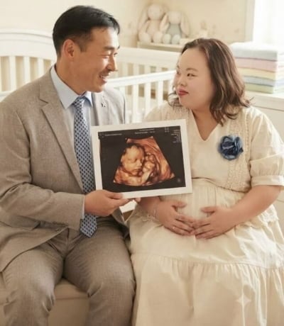 '다운증후군 작가' 서은혜, 아기 초음파 사진 깜짝 공개했다…♥남편 조영남과 다정한 모습