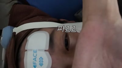이민정, 피부과 시술 직후 얼굴 공개했다…심각한 몰골 "떨리는 게 보여"