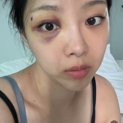 10기 옥순, 가정폭력 당한 거 아니라고…“피가 뚝뚝 떨어져” 그래도 라방