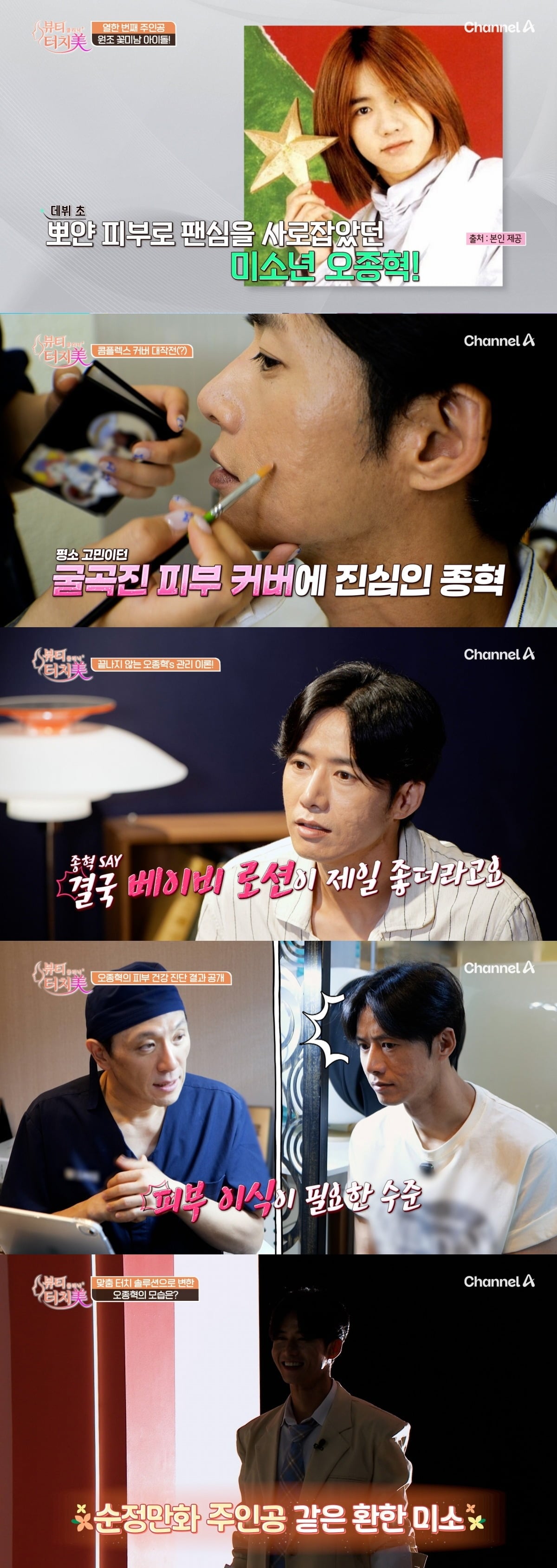 그룹 클릭비 출신 오종혁이 오랜 시간 여드름과 흉터로 고민해 온 사실을 털어놓는다./사진제공=채널A