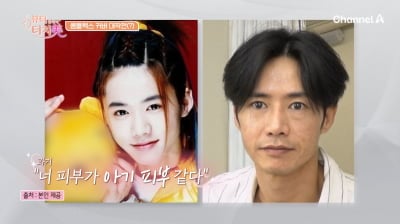 오종혁, '귤껍질 피부' 드디어 치료했다…되찾은 원조 꽃미남 비주얼 ('터치미')