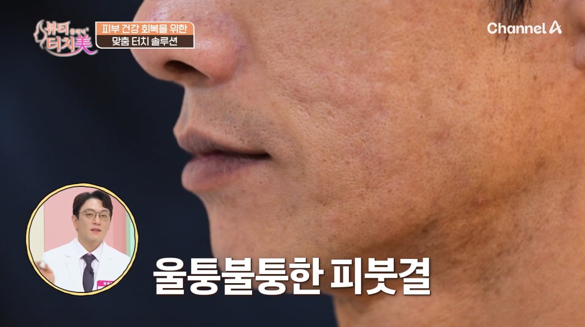 사진=채널A '뷰티클리닉 터치미'