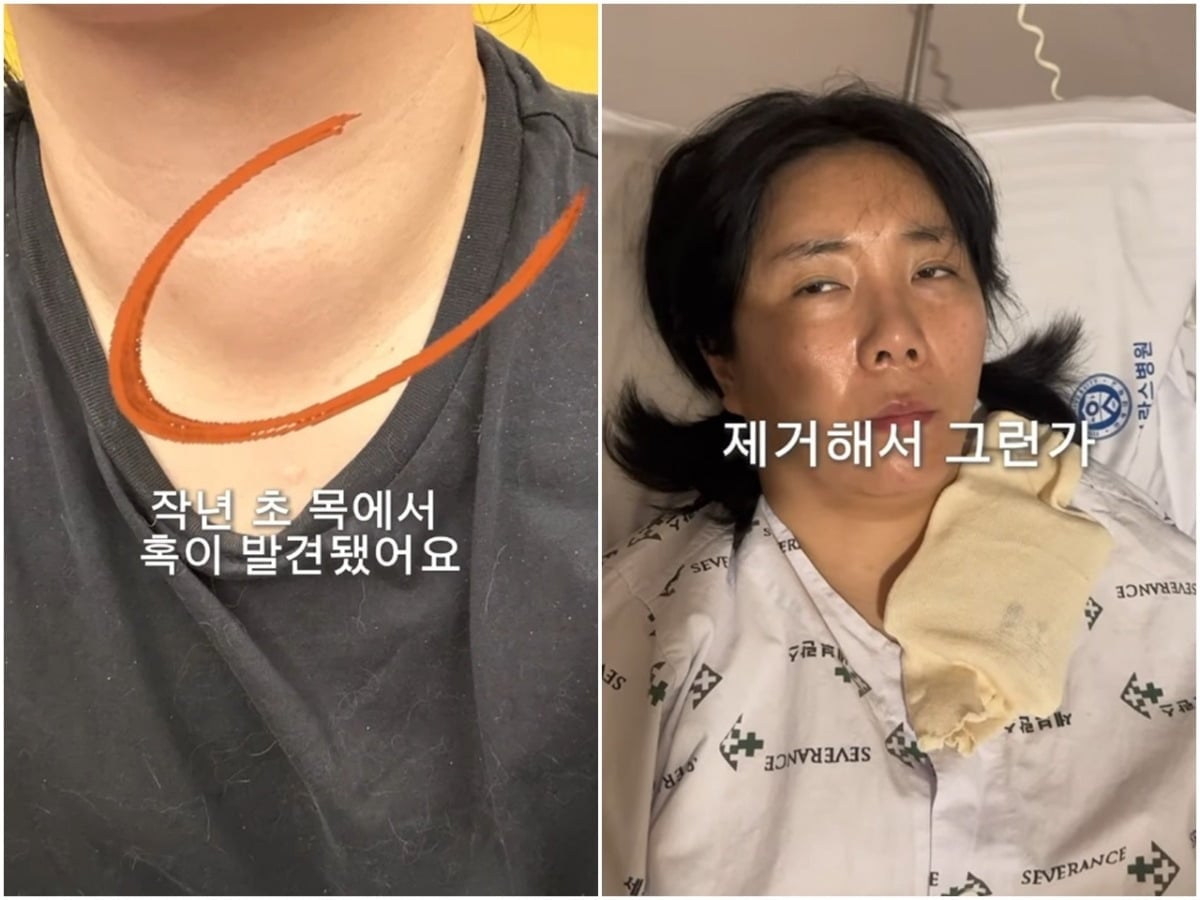 허안나(41)가 갑상선 종양 수술 이후 극심한 피로감에 시달리고 있다고 털어놨다. / 사진=허안나 SNS 캡처