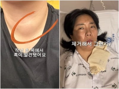 '41세' 허안나, 갑상선 종양 수술 고백…"재작년 초 발견, 75% 제거하니까 손 까딱하기 힘들어"