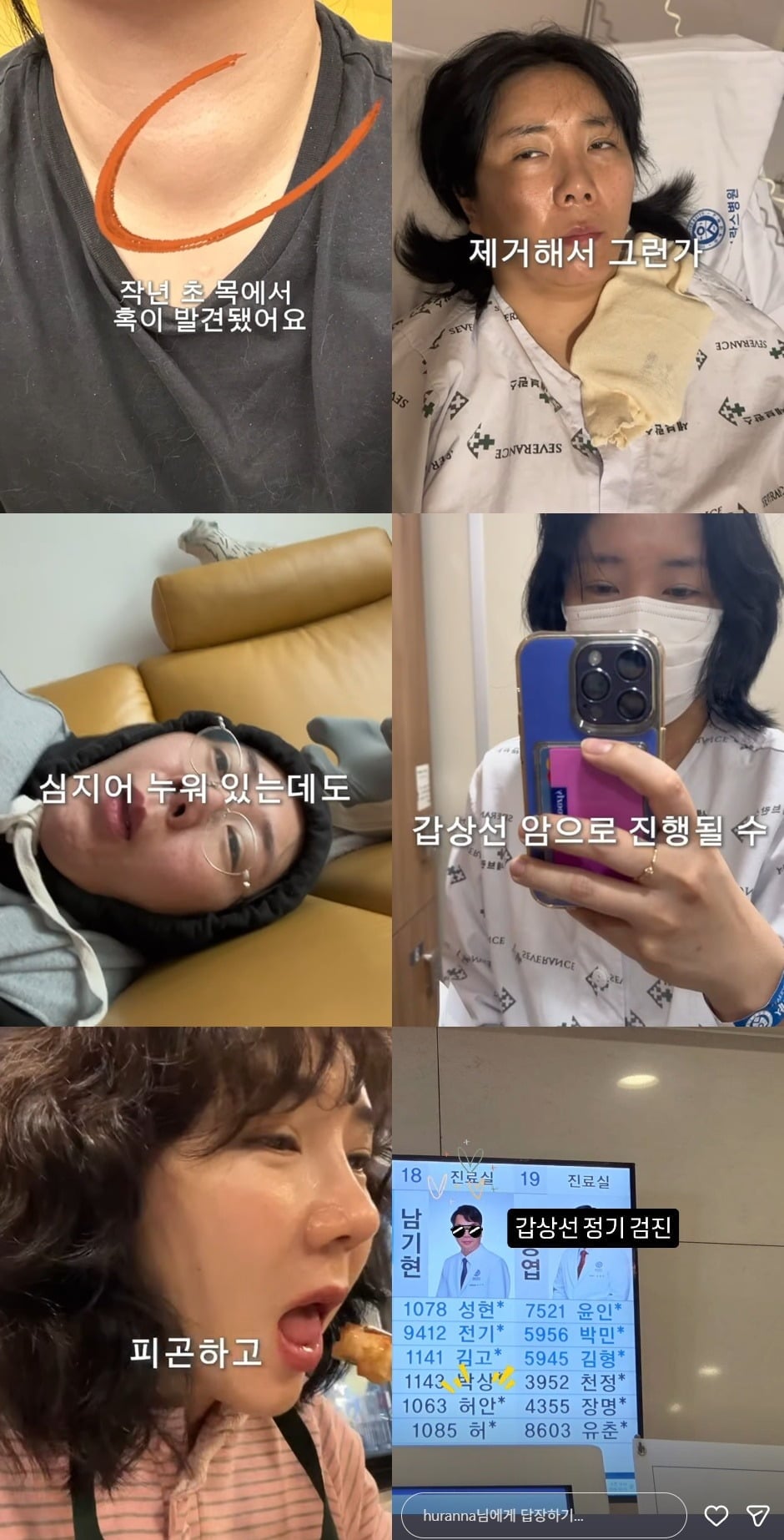 허안나(41)가 갑상선 종양 수술 이후 극심한 피로감에 시달리고 있다고 털어놨다. / 사진=허안나 SNS 캡처