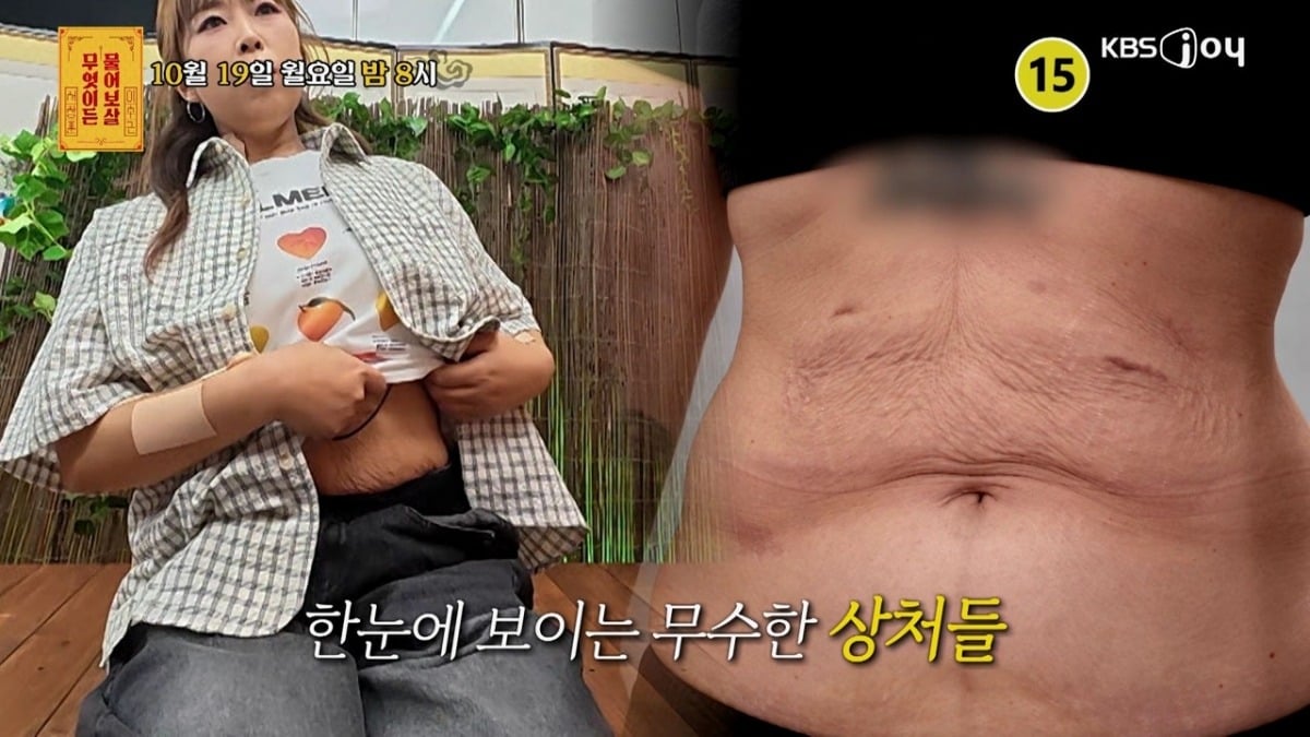 수술 후 6개월 만에 40kg 빠진 사연자가 고민을 털어놓는다. /사진제공=KBS Joy