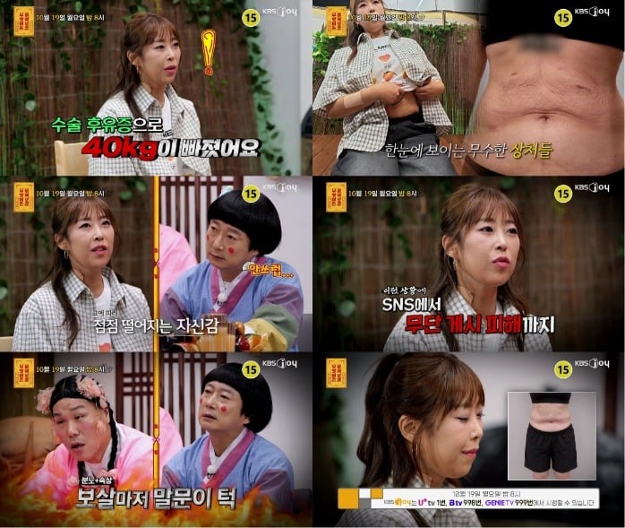 수술 후 6개월 만에 40kg 빠진 사연자가 고민을 털어놓는다. /사진제공=KBS Joy