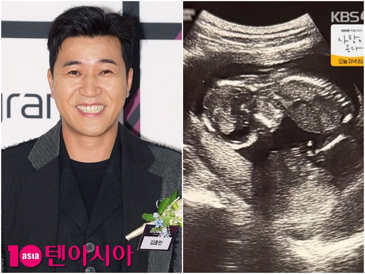김종민의 공식 행사 참석 모습(왼쪽)과 KBS2 '1박 2일 시즌4'에서 공개된 아들의 초음파 사진(오른쪽). / 사진=텐아시아DB, KBS2 방송 화면 캡처