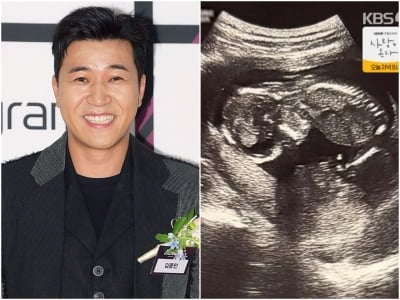 '11살 연하♥' 김종민, 5개월 후 아빠 된다더니…초음파 사진 공개 "아내 순산 기도" ('1박')[종합]