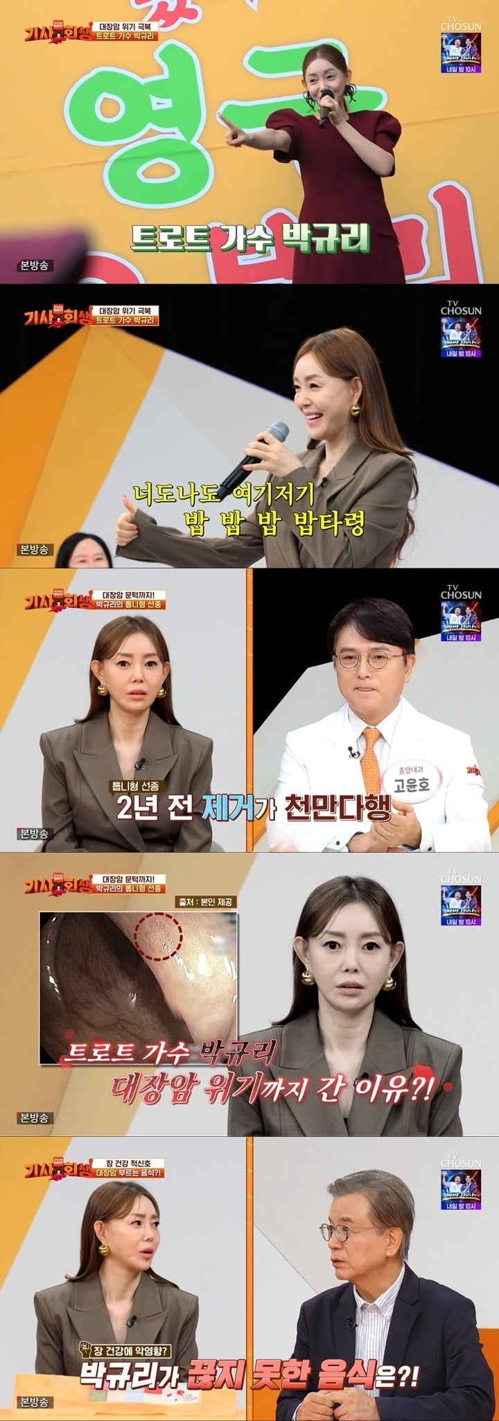박규리가 대장암으로 발전할 위험이 있는 톱니형 선종을 발견했던 과거를 털어놨다. / 사진=TV조선 방송 화면 캡처