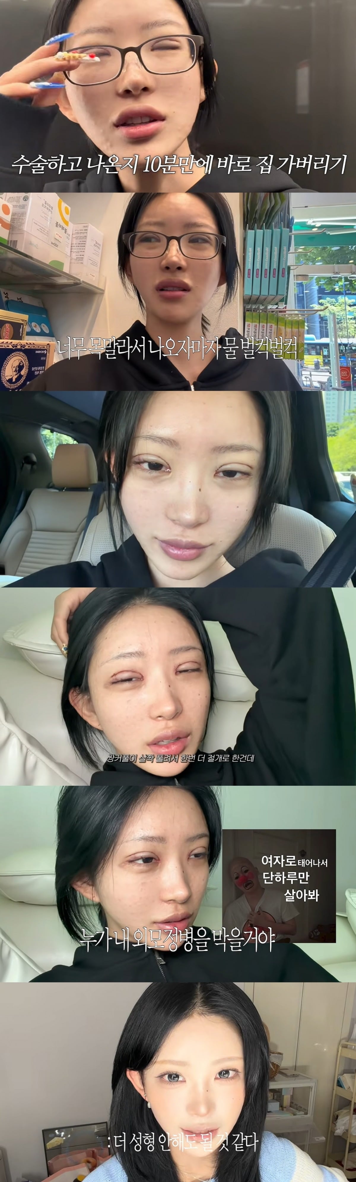 최준희가 쌍커풀 재수술 근황을 밝혔다./사진='준희'