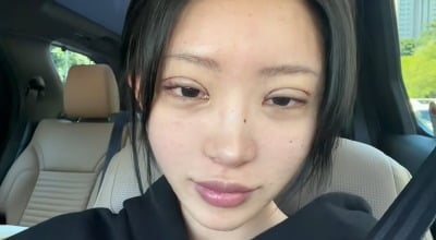 "성형 못 끊어" 故최진실 딸 맞아?…최준희, 얼굴 또 고쳤다 "반대해도 할 것"