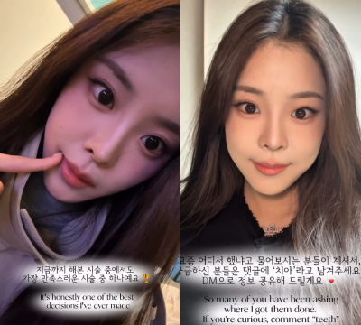 '미코 진' 우서윤, 성형설 2개월 만에 시술 고백했다…"치아 모양 개선, 자신감 생겨"