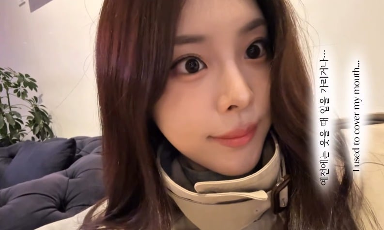 우서윤이 치아 시술 사실을 털어놨다. / 사진=우서윤 SNS 