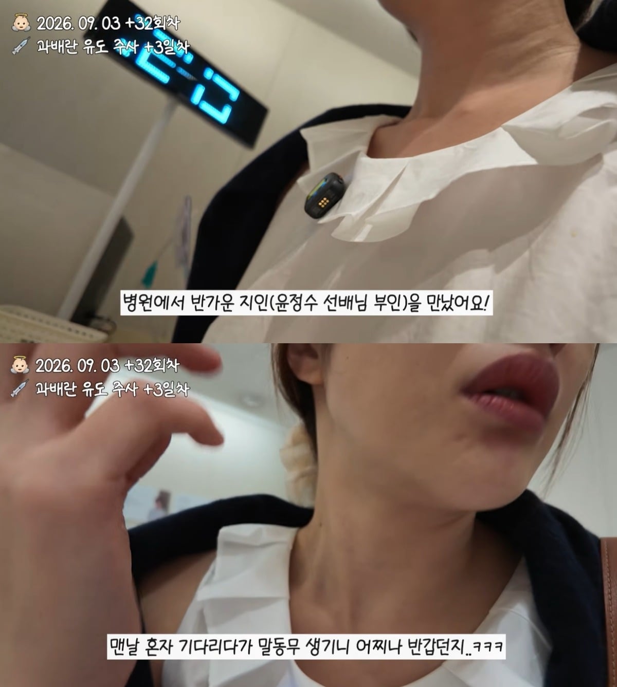 황보라와 원진서가 시험관 시술 부작용에 대해 이야기를 나눴다. / 사진=유튜브 채널 '황보라 보라이어티' 영상 캡처