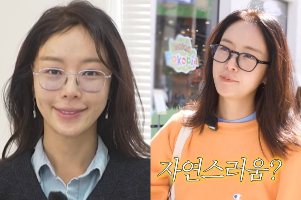 배우 황정음이 실리프팅 시술로 인해 미소가 부자연스러워졌다고 말했다. / 사진=유튜브 채널 '황정음' 영상 캡처