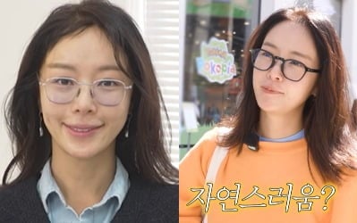 "조커 같아" 황정음, 실리프팅 후 어색한 미소…'자연스러움'이 추구미라더니 ('황정음')