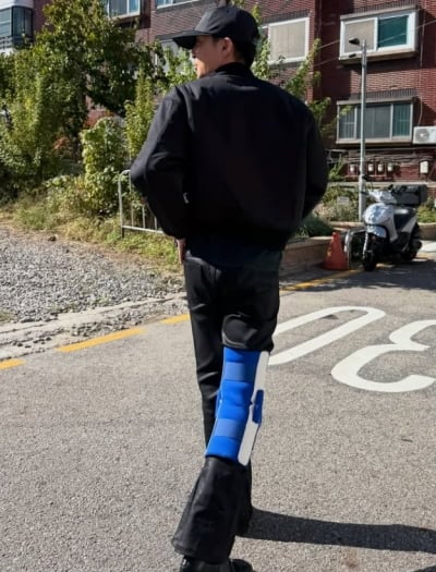 로이킴, 공연 한 달 앞두고 '낙상사고'…"14년 만에 떨어져 봤다"